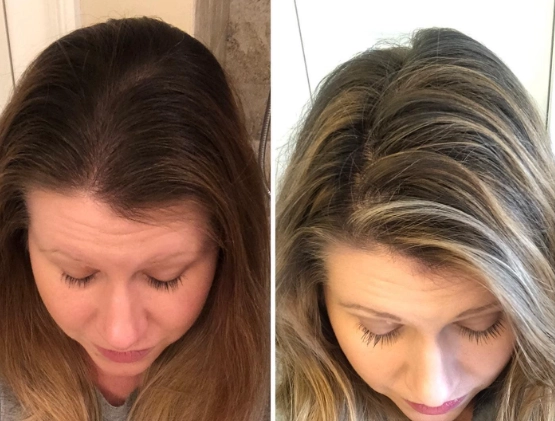 hair dye health risks