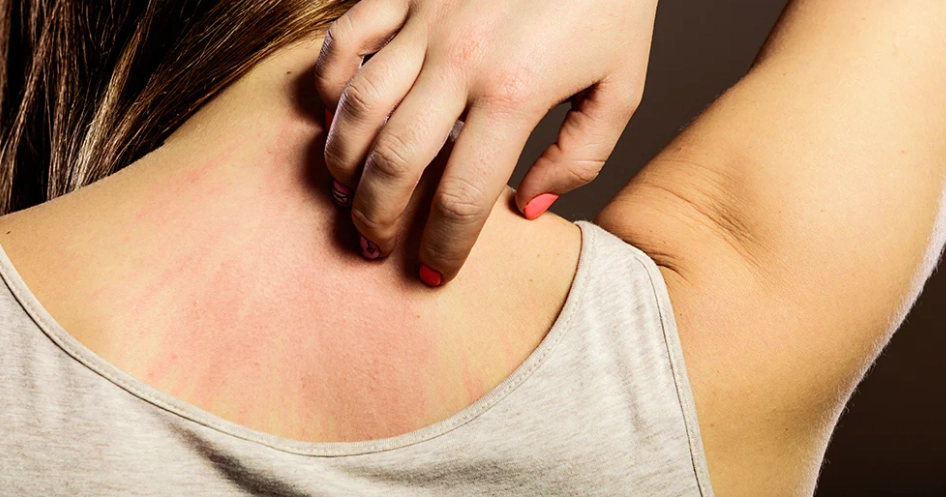 can modal fabric cause skin irritation