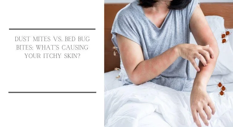 allergy relief bedding